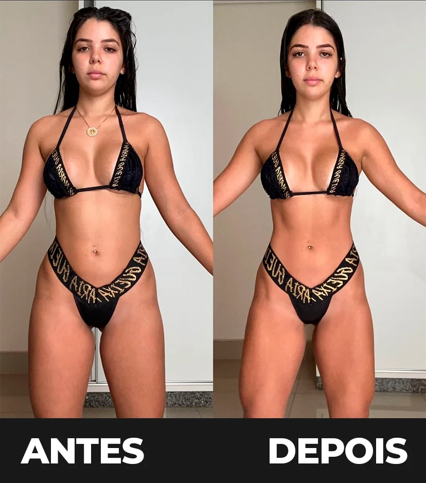 Resultado Antes e Depois 2