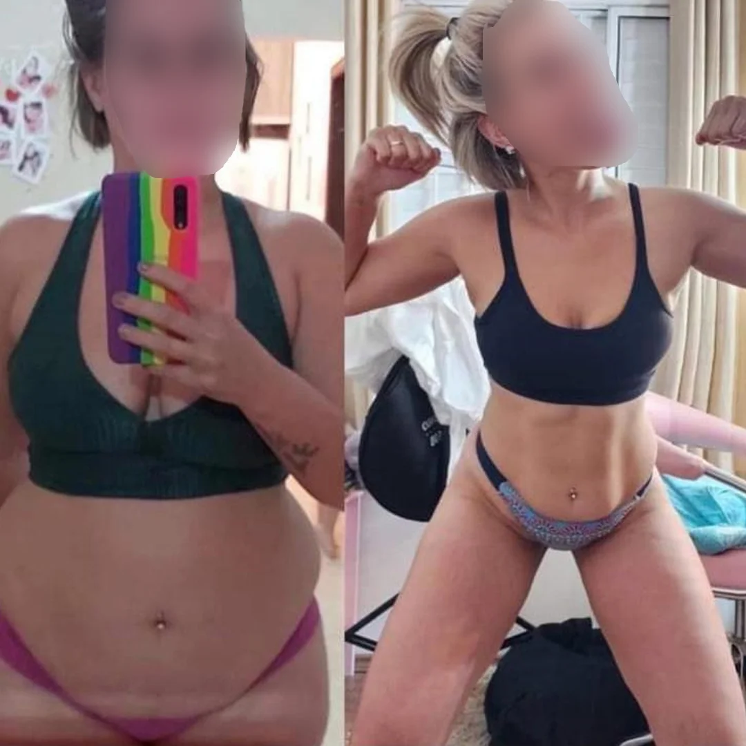 Resultado Antes e Depois 1